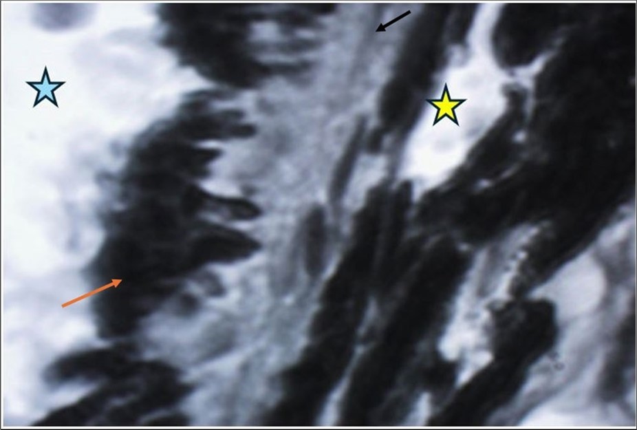 Bruch's membrane (black arrow) forms the basement membrane of the cells of the pigmented epithelium of the retina (orange arrow). The yellow star indicates the spaces inside the capillaries in the choroidal layer, and the blue arrow indicates the region that corresponds to the subretinal space, where the retinal photoreceptors (cones and rods) are normally located.
