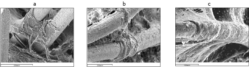 International Journal of Human Anatomy-reparative osteogenesis